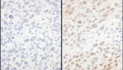 integrin beta 4 binding protein Antibody, Novus Biologicals 0.1mg; Unlabeled:Antibodies,